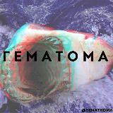 HEMATOMA